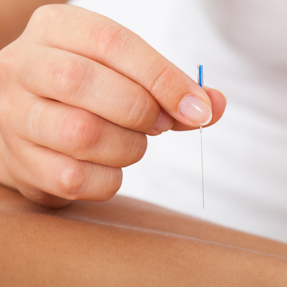 Acupuncture and Traditional Chinese Medicine (TCM)