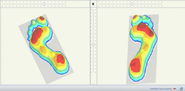 Custom Foot Orthotics