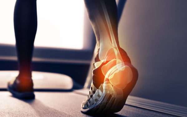Heel Pain whilst walking on a treadmill