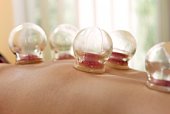 Cupping Therapy