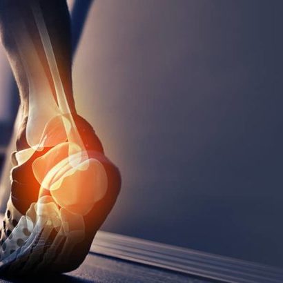 Heel Pain whilst walking on a treadmill